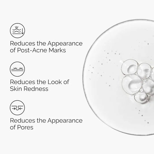 Aloe 2% + NAG 2% Solution for Post-Acne Marks